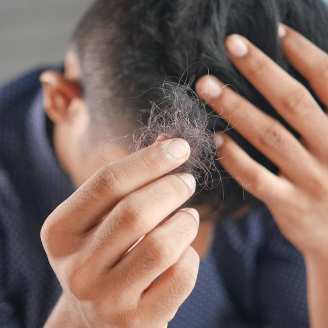 Comment certains suppléments peuvent-ils ralentir la chute des cheveux ?