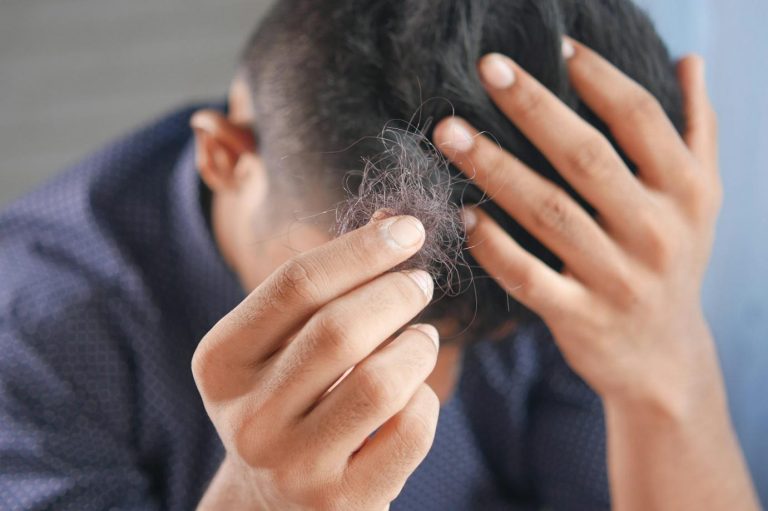 Comment certains suppléments peuvent-ils ralentir la chute des cheveux ?