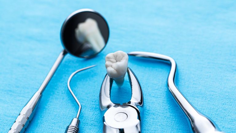 Pourquoi les dents de sagesse sont-elles de tailles différentes ?