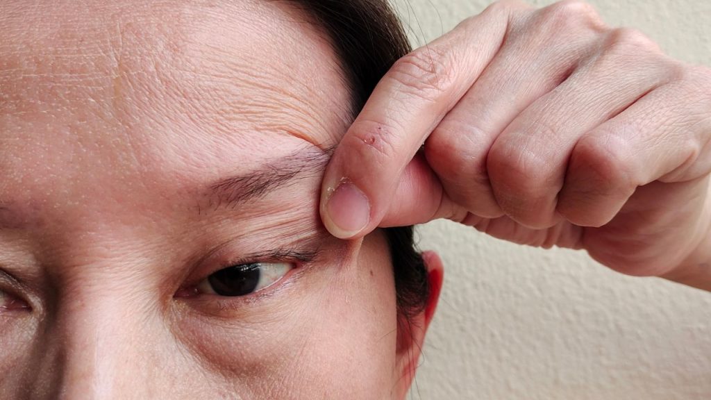 Image paupière qui saute